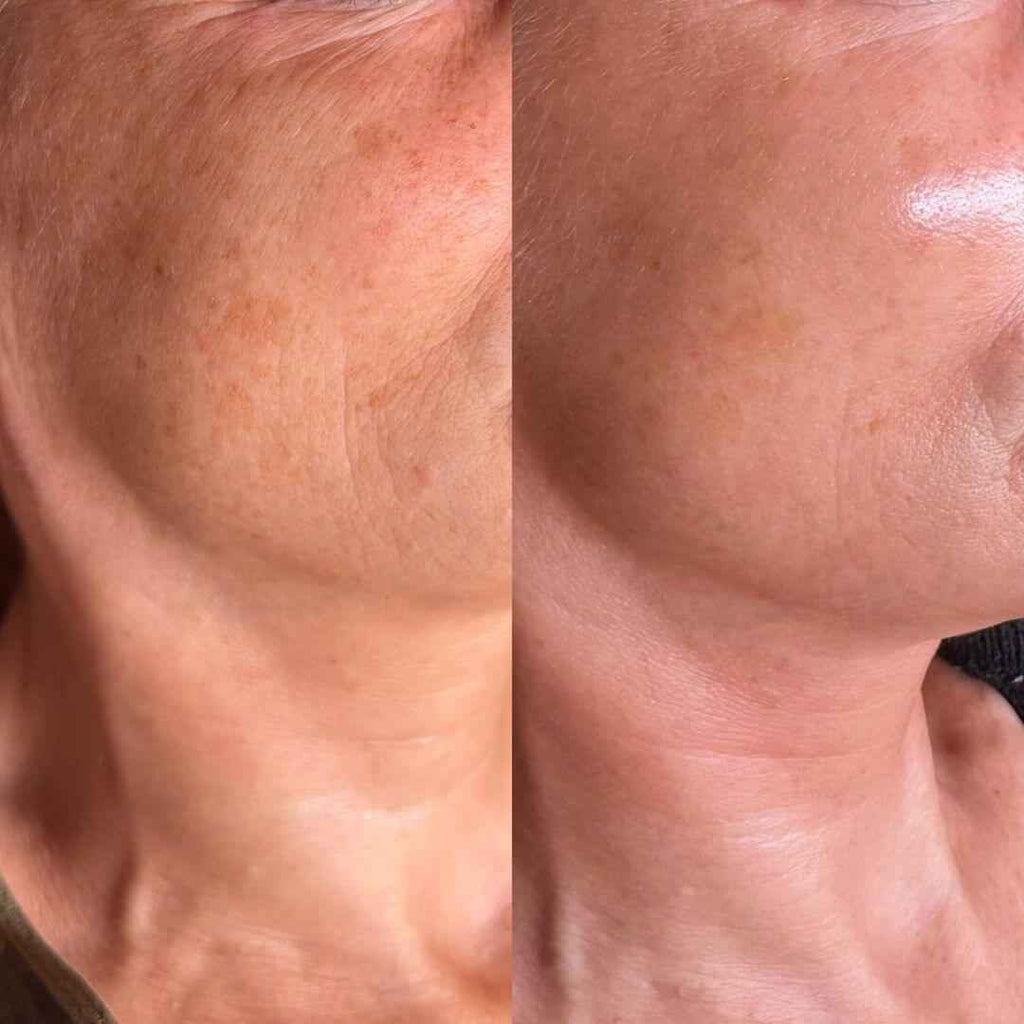 Elixir Serum - 24kGold Ginseng Root Niacinamide Vitamin C