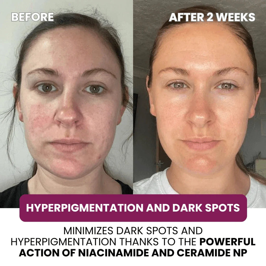 Collagen & Niacinamide wrapping mask
