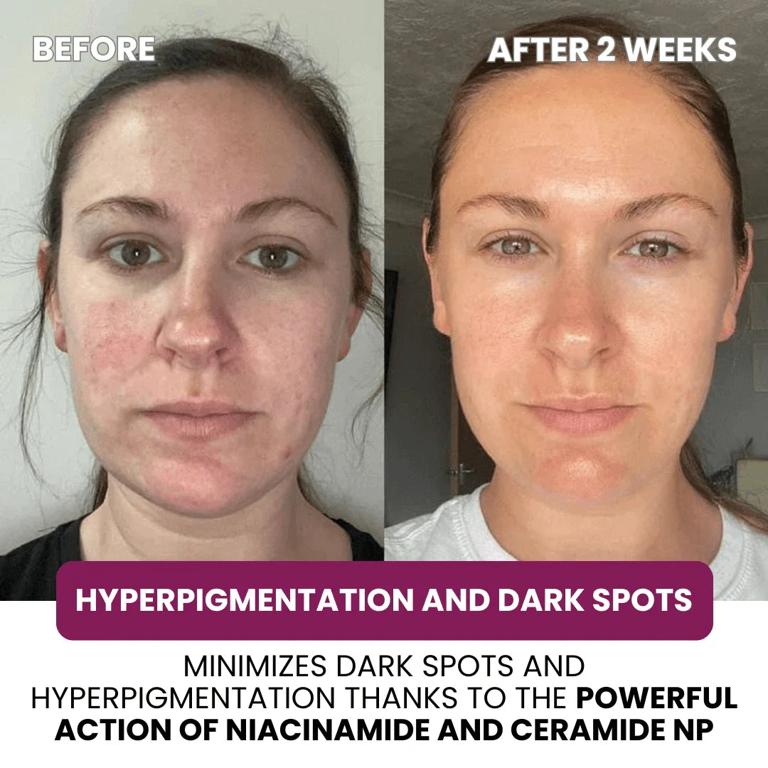 Collagen & Niacinamide wrapping mask