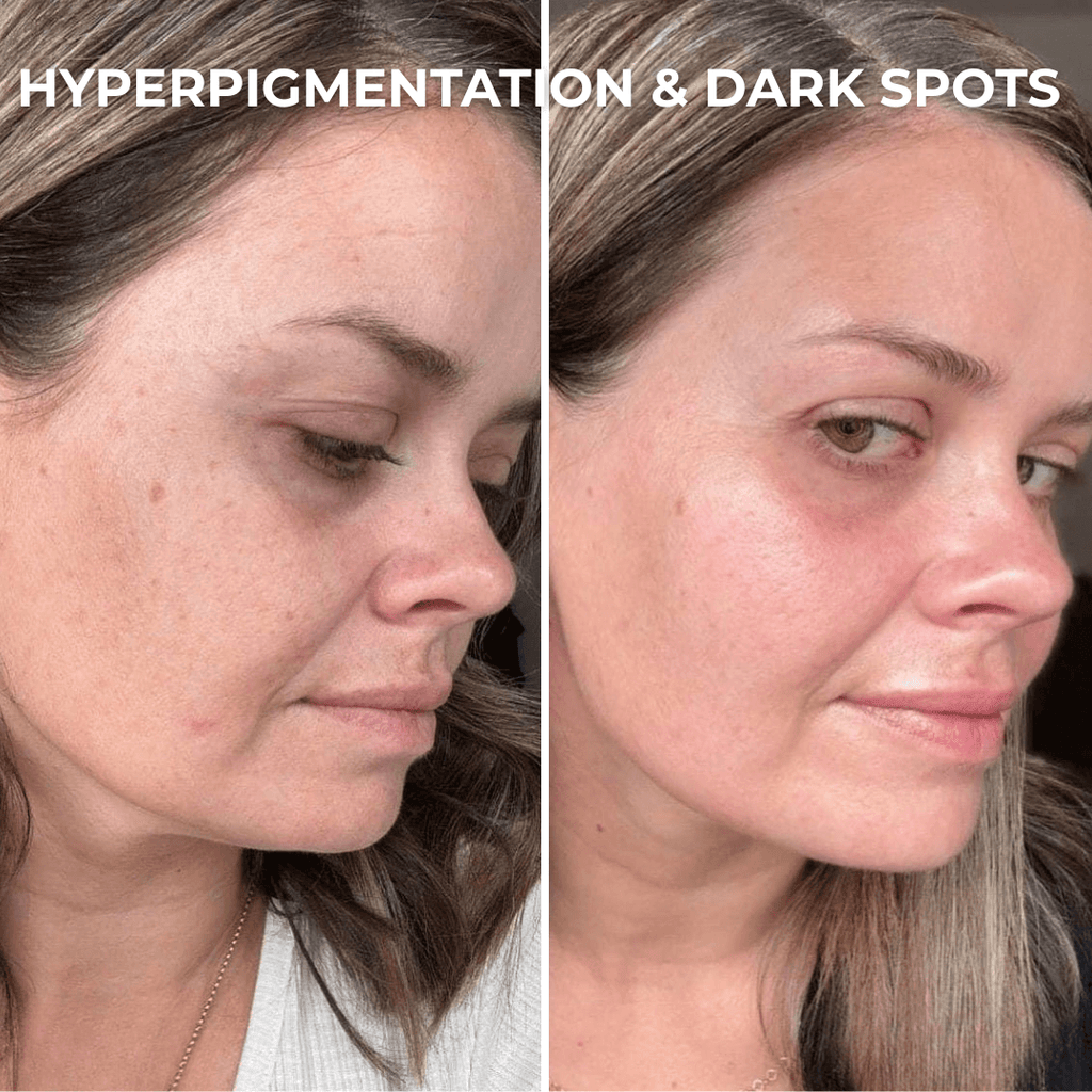 PDRN Collagen Peptide Hydrogel Mask