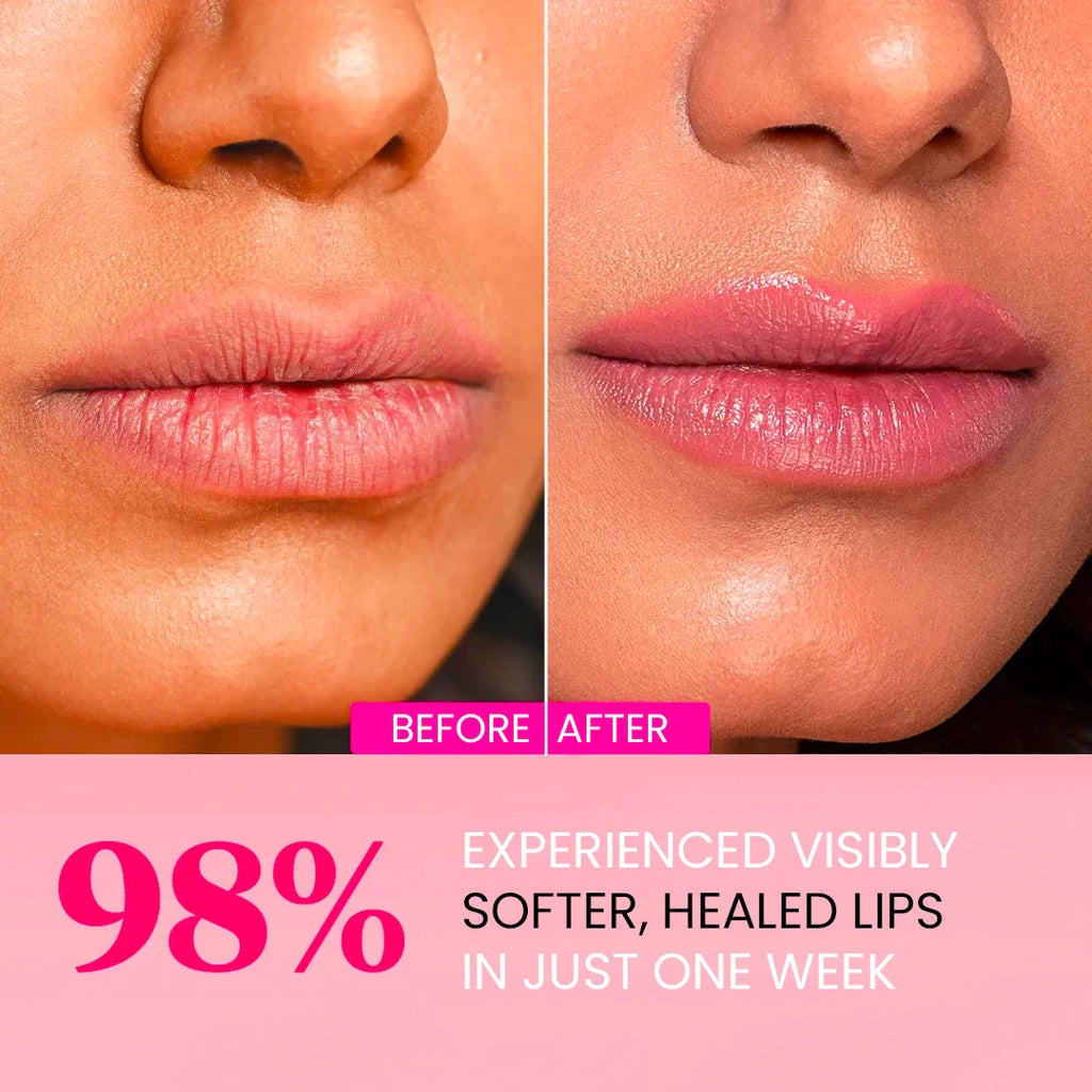 Plumping Lip Masks - Collagen, Hyaluronic Acid, Centella Asiatica